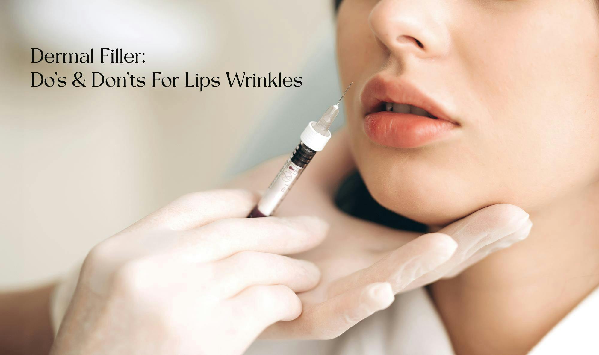 dermal-filler-do-and-do-not-lips-wrinkle
