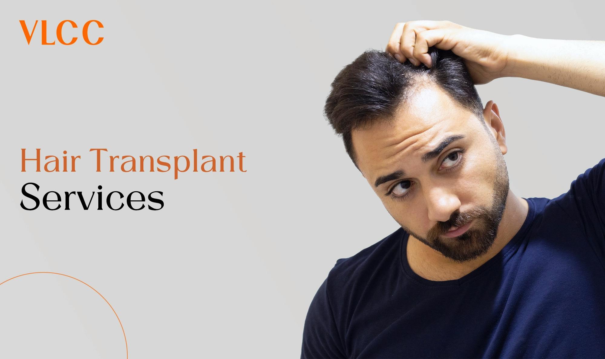 VLCC Hair Transplant Services