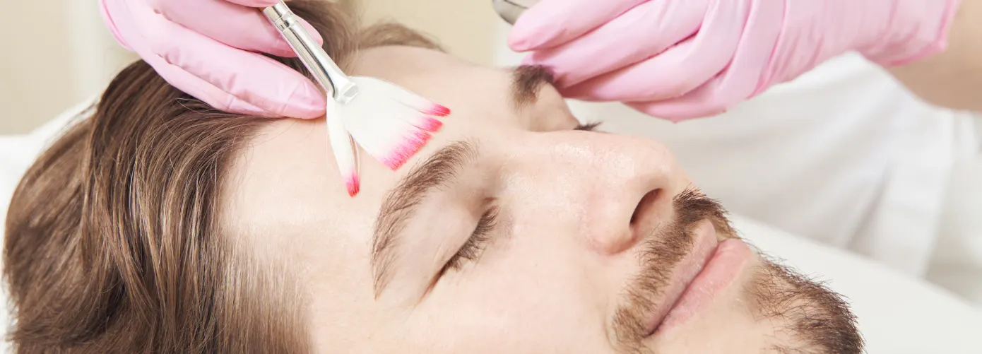 Chemical Peel Price in India: Cost Factors & Saving Tips
