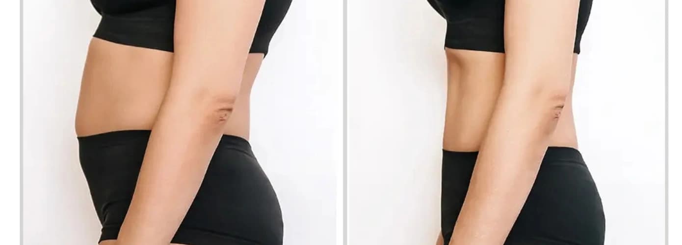 Post Pregnancy Diet Plan for Weight Loss
