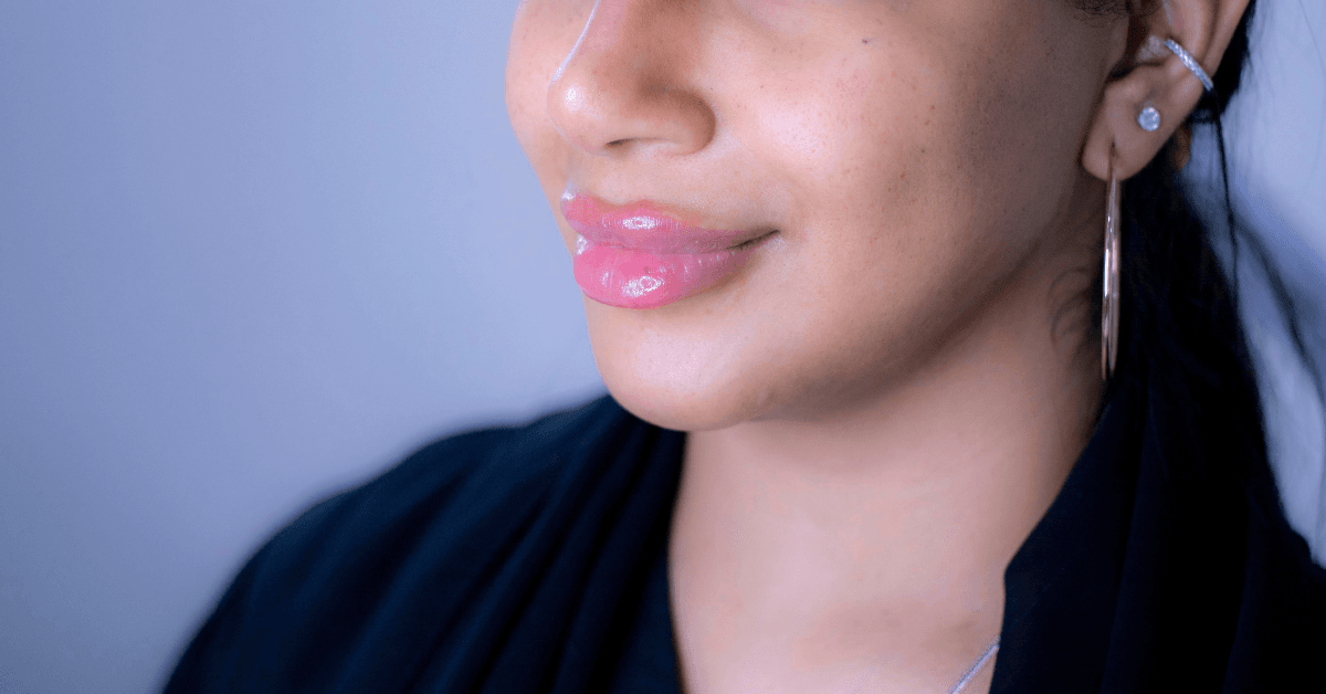 Dark Lips aka Smoker’s Lips Treatment in Dubai