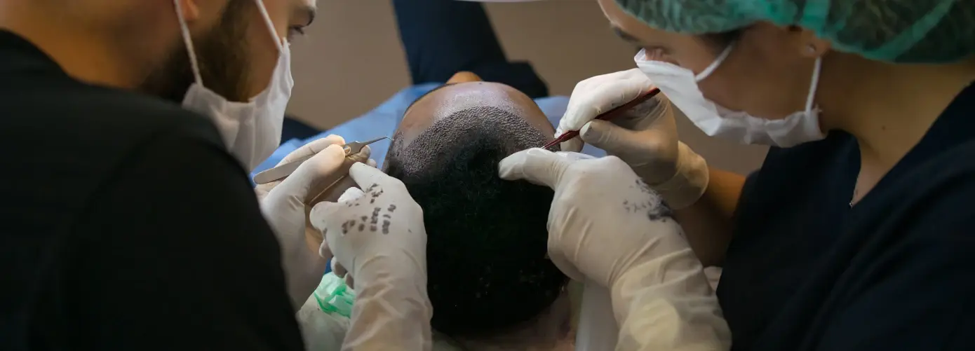 Hair Transplant in Dubai: Procedure, Benefits & Cost