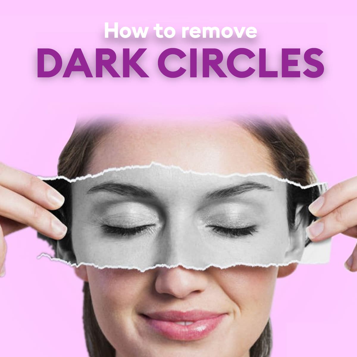 dark circles under eyes