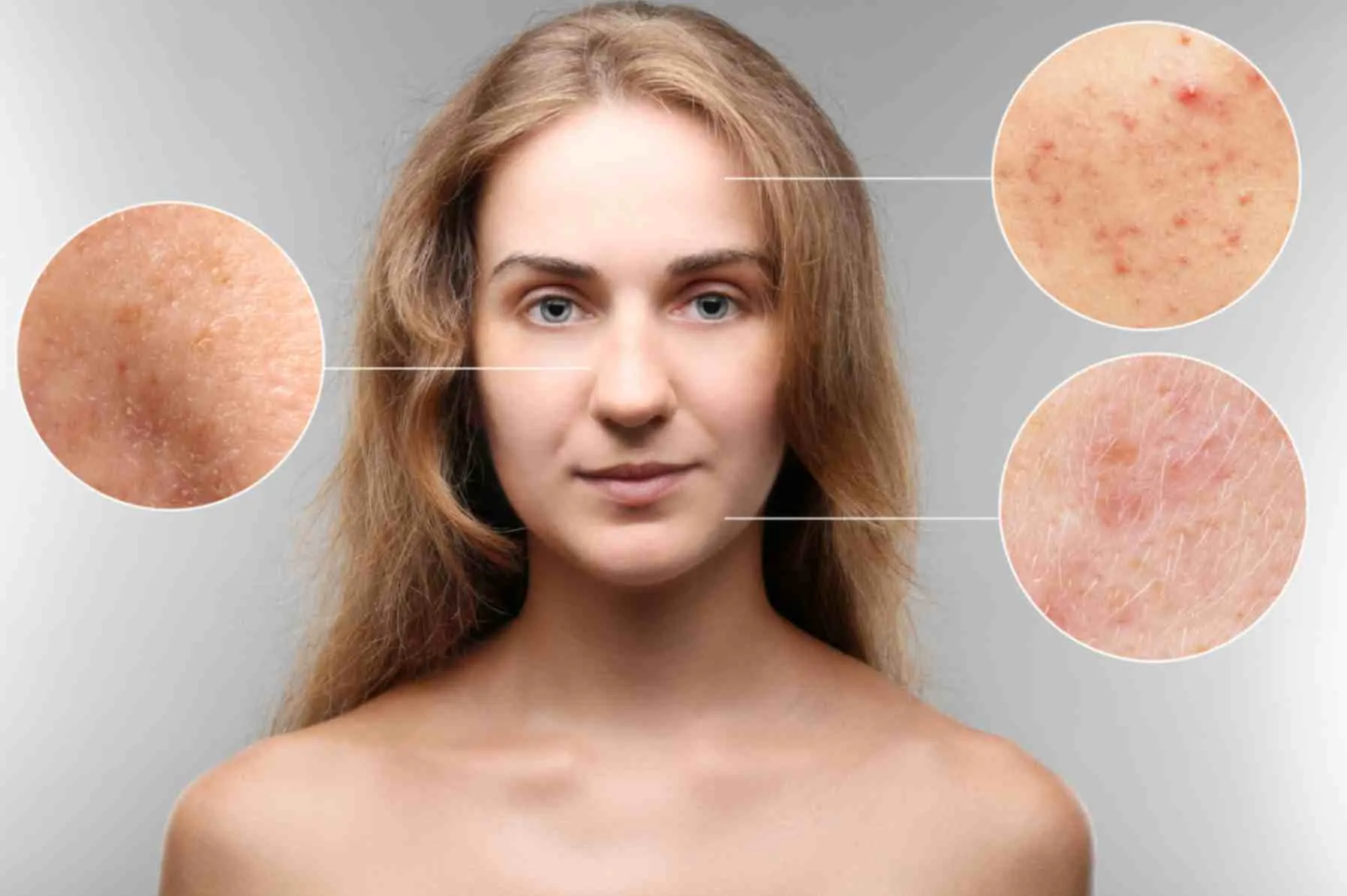 best dermatologist in Pune for acne