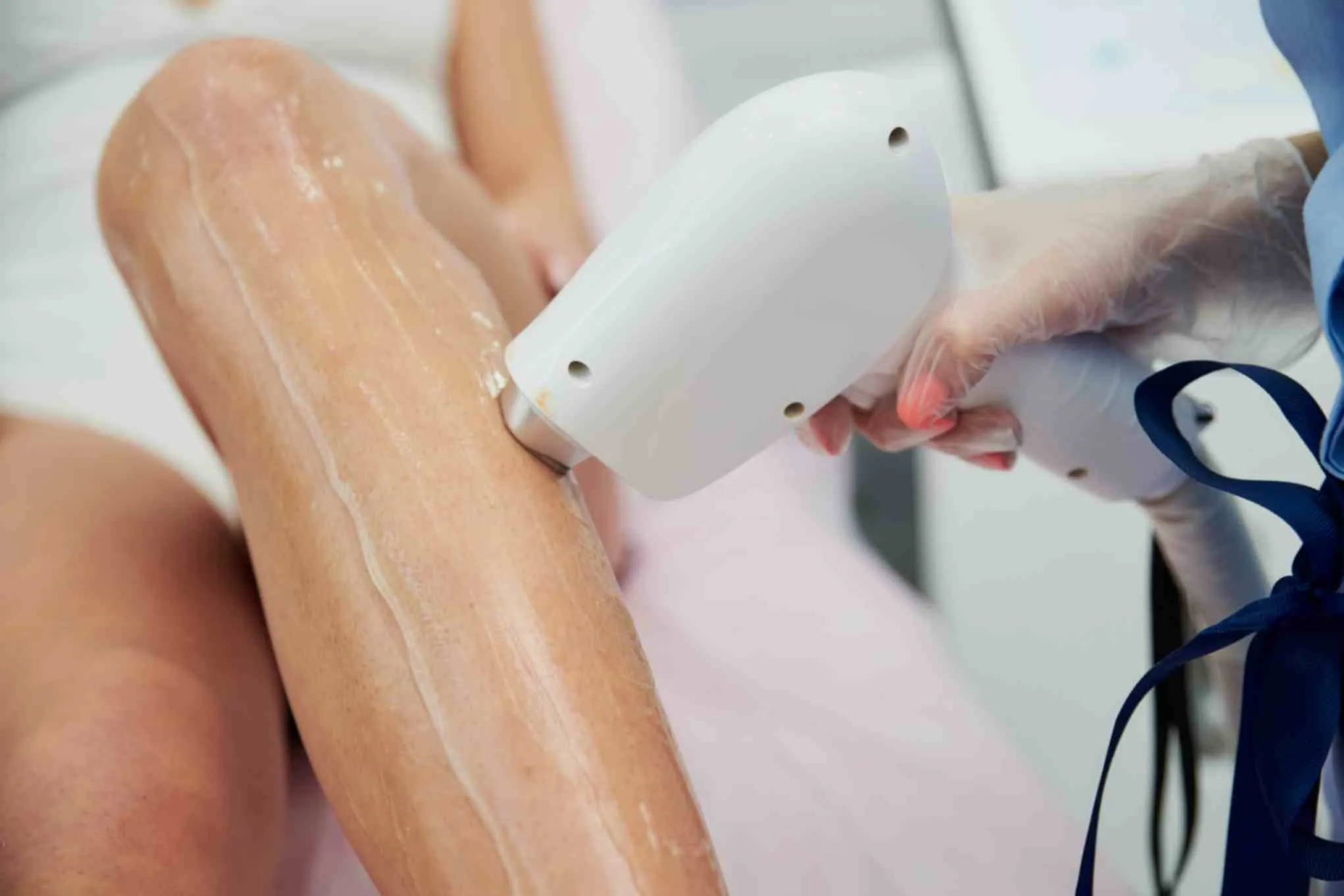 VLCC Laser hair removal