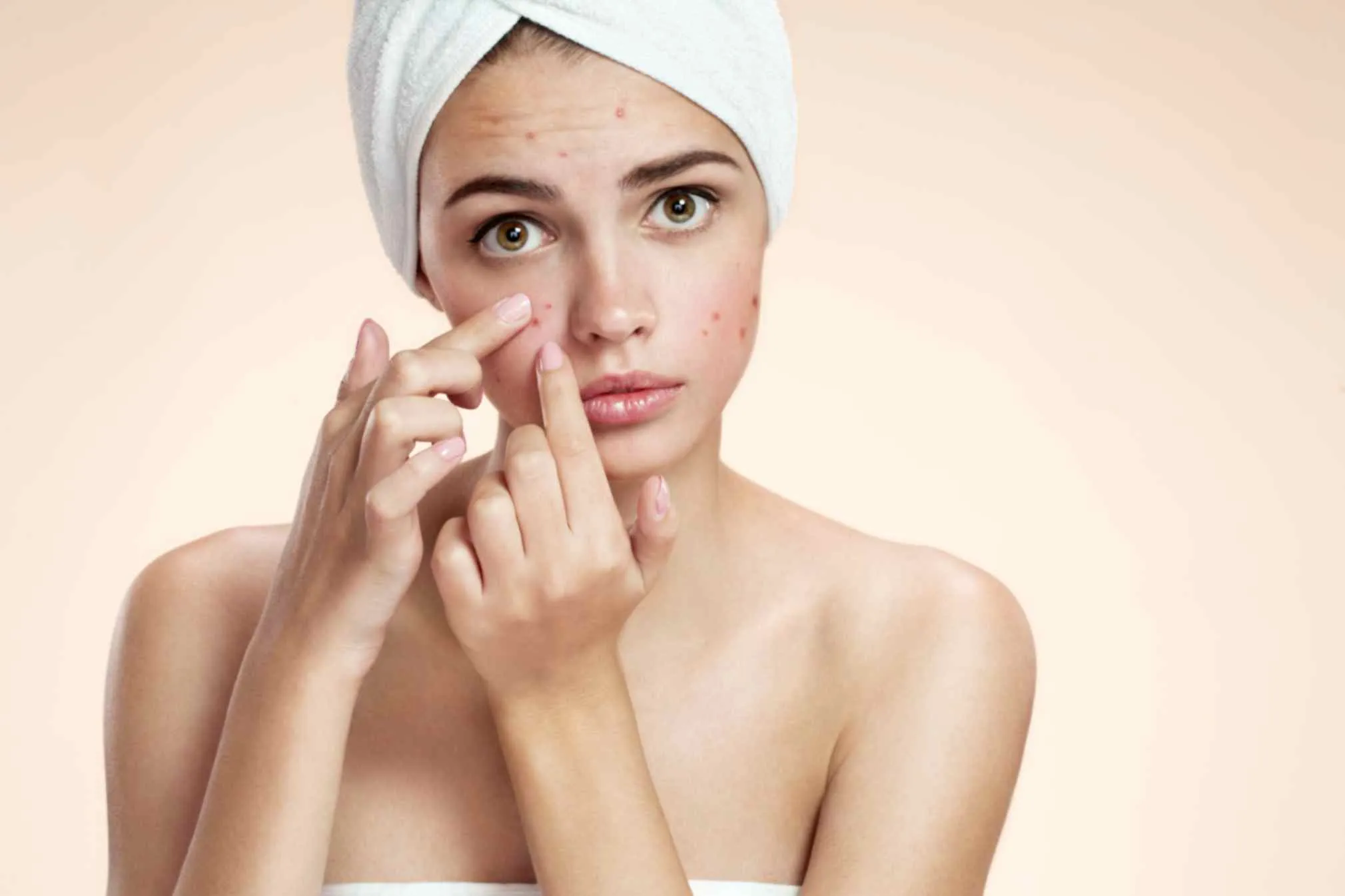 How to find the best dermatologist in Hyderabad