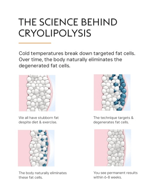 Cryolipolysis (Coolsculpting) Treatment Cost for Fat Loss | VLCC