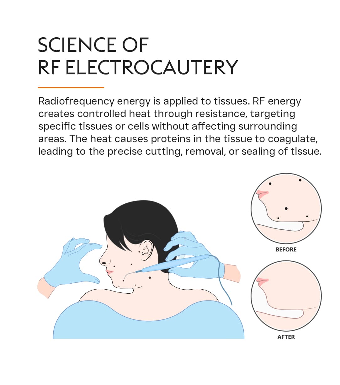 Body Therapy 2