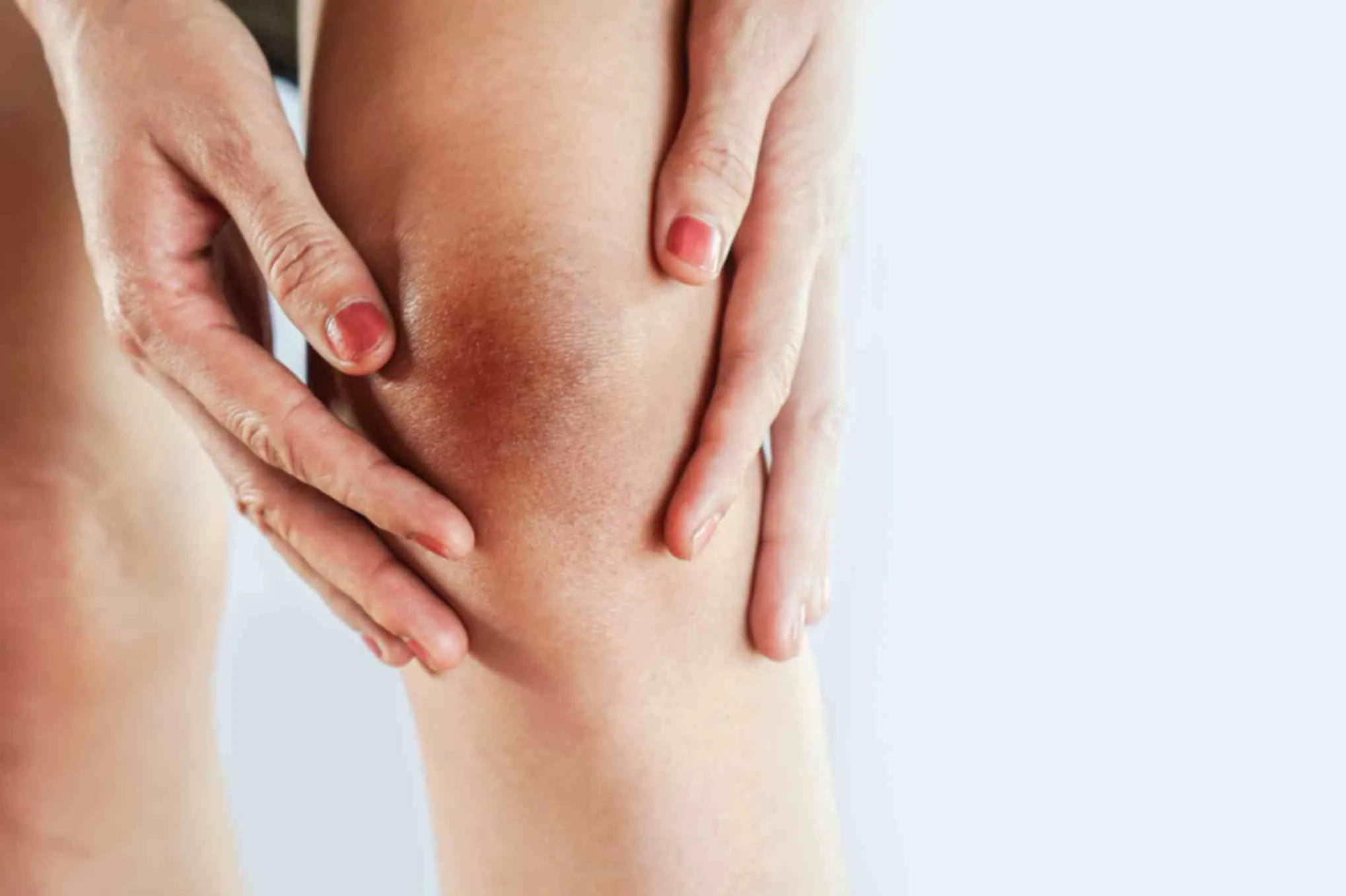 knee cap pigmentation skincare solutions