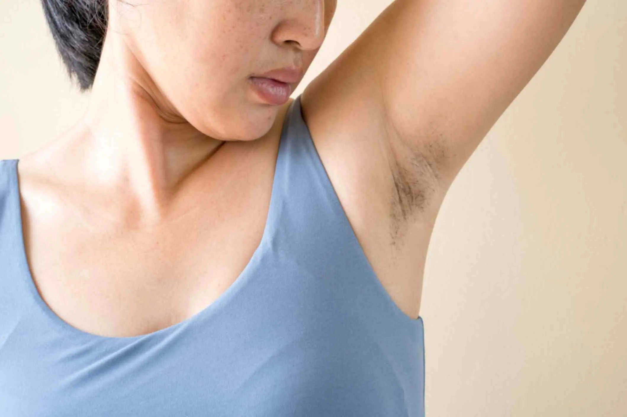 underarm pigmentation skincare solutions