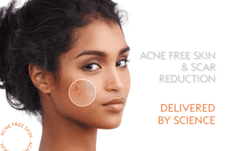 Acne & Scars
