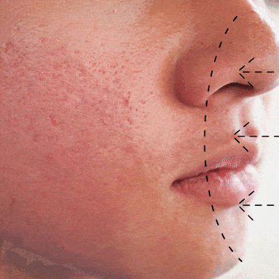 Reduce Pore size