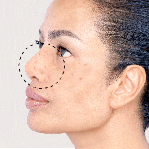 Reduced Dark Spots