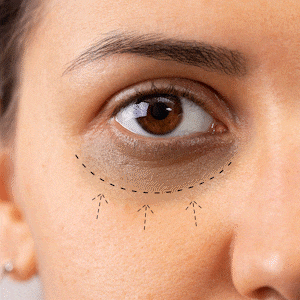 Reduces Under Eye Dark Circle