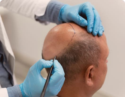 Advanced Therapies