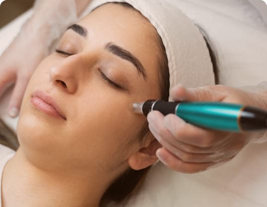 VLCC microneedling rf treatment for skincare solution