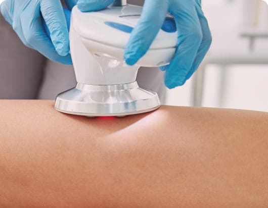 V-Fit Treatment