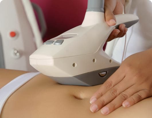 V-Fit Treatment