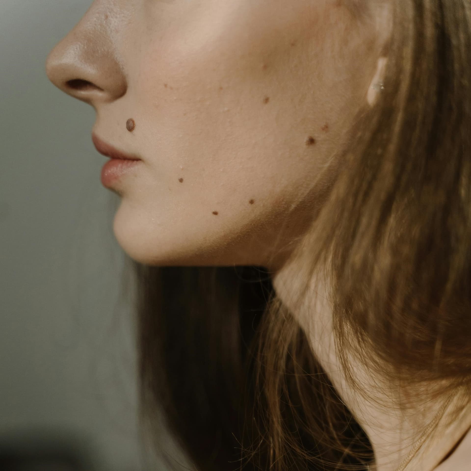Acne Clear