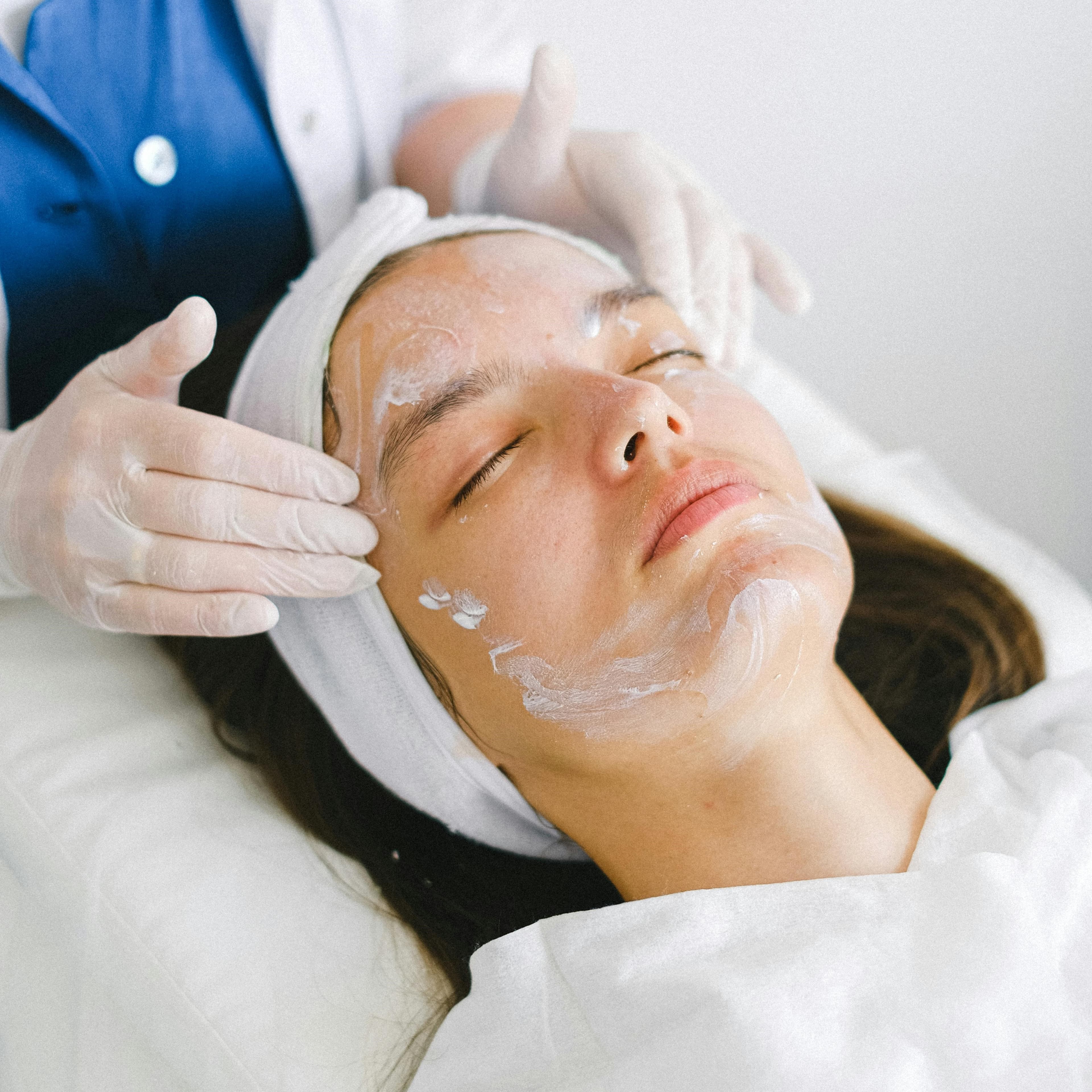 VLCC TCA Chemical Peels Skin Whitening Treatment