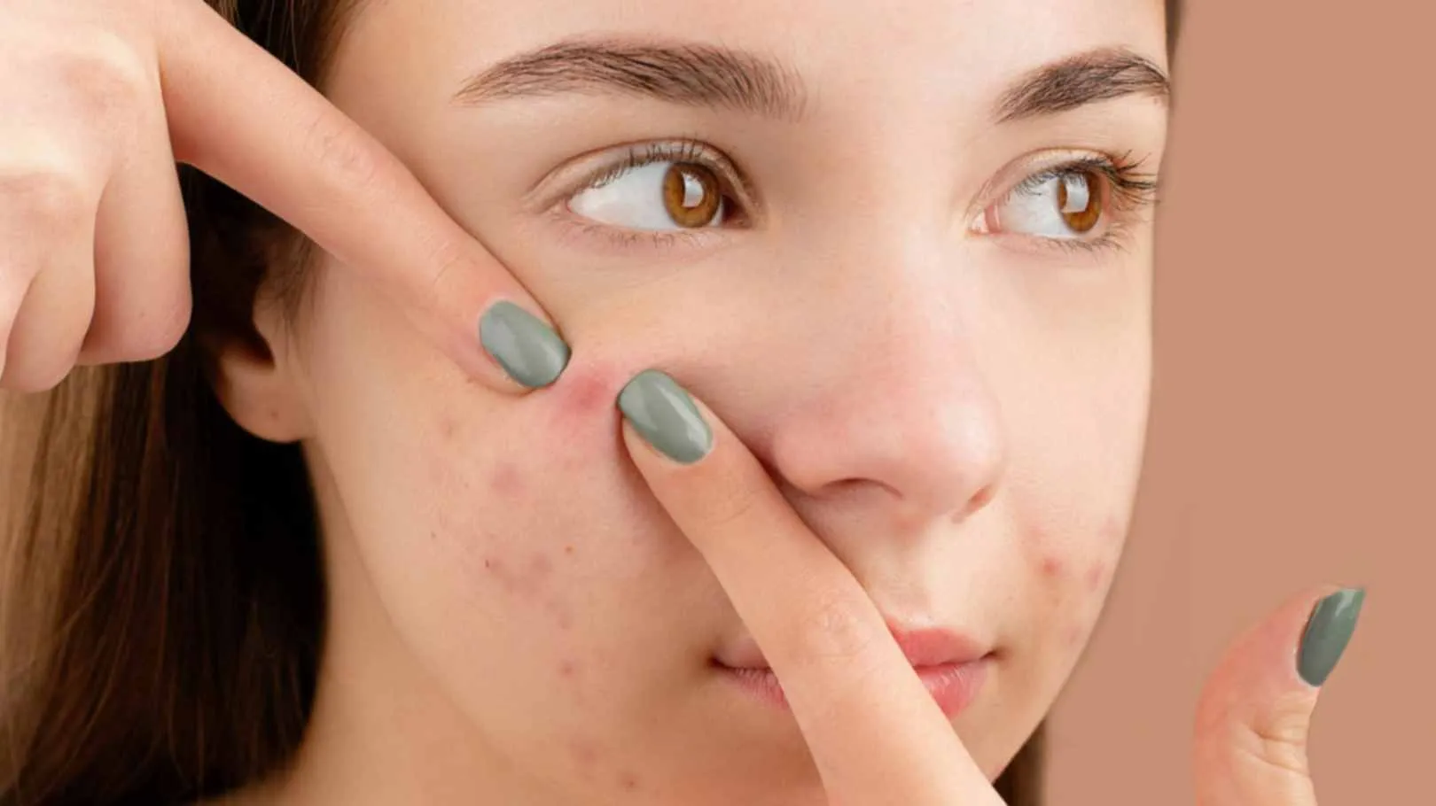 Dermatologists in Chennai