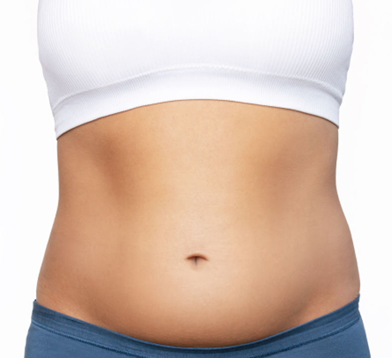 Abdomen before